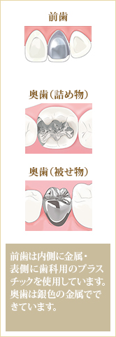 保険適用の素材