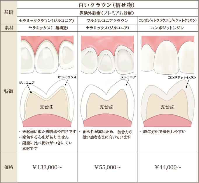 白いクラウン（被せ物）