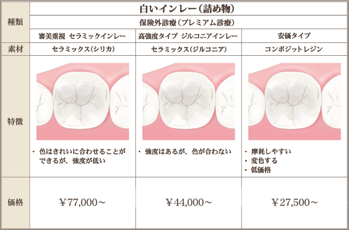 白いインレー（詰め物）