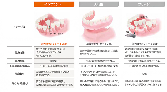 歯を失ってしまったときの選択肢は3つあります