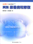補綴臨床　実践　接着歯冠修復 松村英雄，川本善和，医歯薬出版，2008
