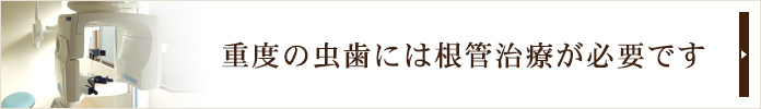 重度の虫歯には根管治療が必要です