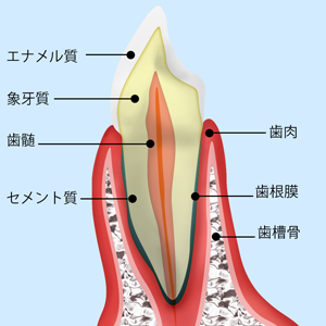 歯が痛い・しみる【虫歯治療】