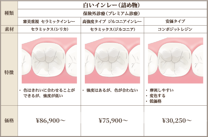 白いインレー（詰め物）